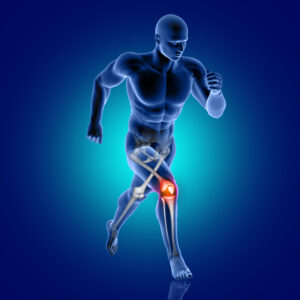 Read more about the article Arthritis